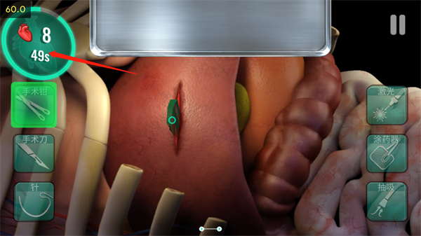 医院手术时间游戏玩法教程 医院手术时间游戏玩法教程
