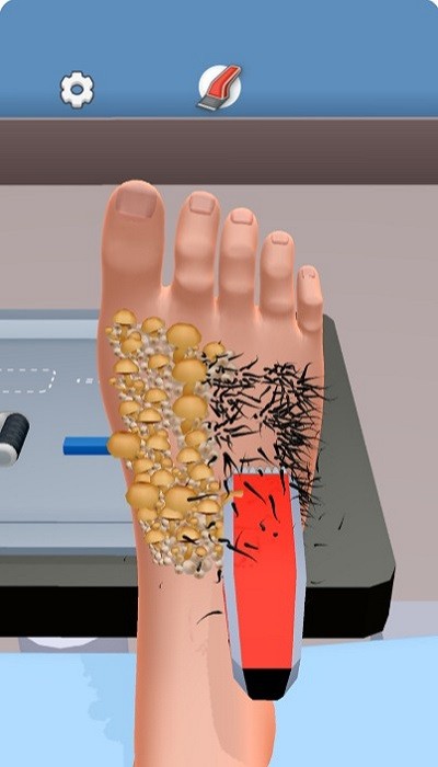 足部护理小游戏